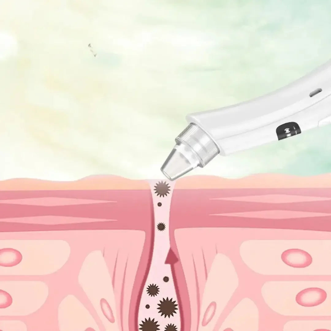 Máquina de limpieza facial